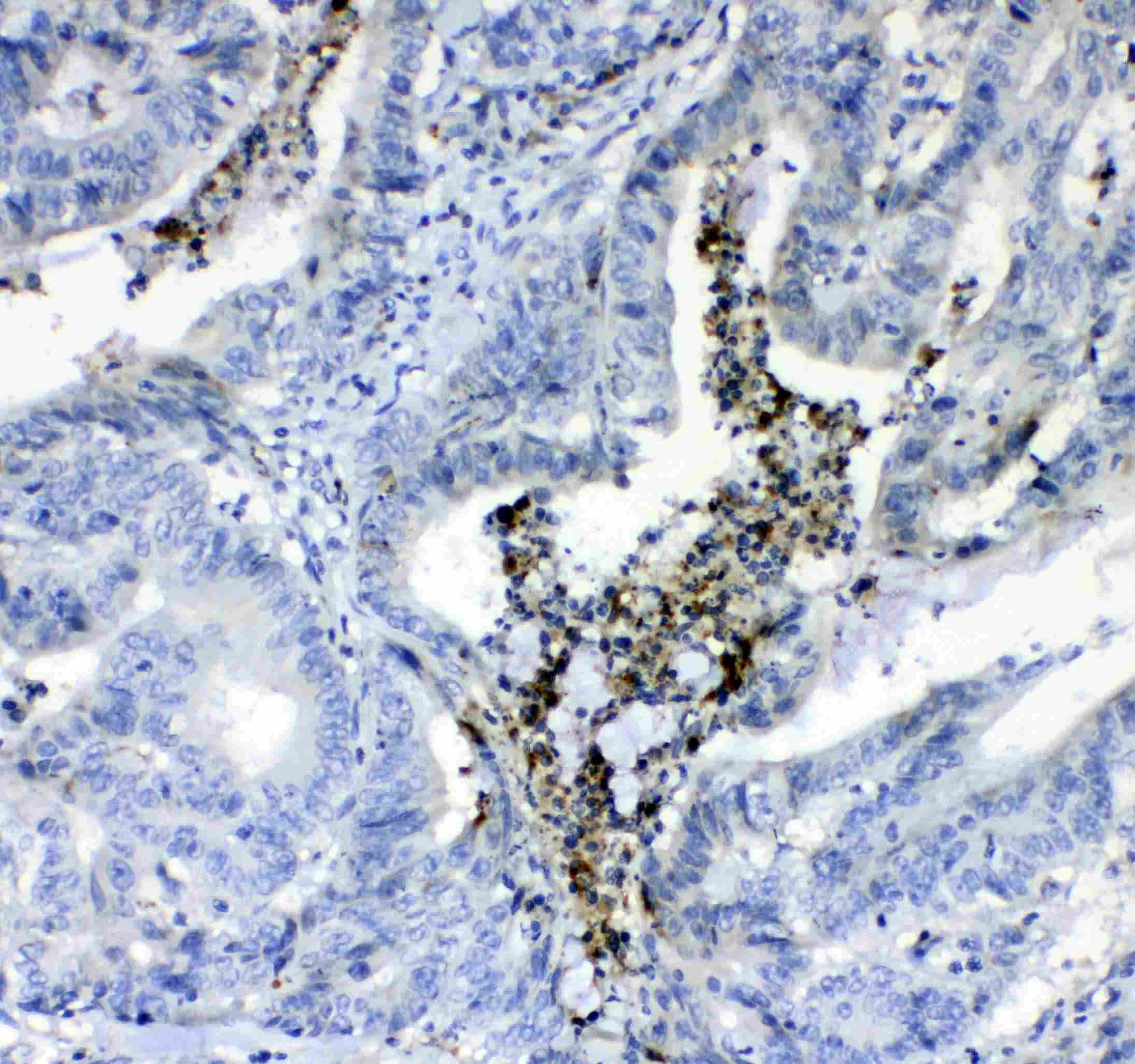 F2 / Prothrombin / Thrombin Antibody