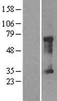 CLIC5 Protein (Over-Expression Lysate Myc-DDK (Flag))