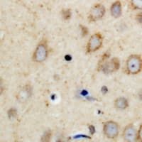 Polyclonal Rabbit anti-Human PPP1R14A / CPI-17 Antibody (N-Terminus, IHC, IF, WB)