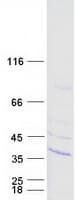 Human SPG21 / MAST Protein (Recombinant Myc-DDK (Flag))