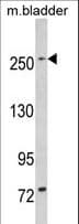 LRRK1 Antibody (aa1981-2015)