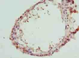 CA3 / Carbonic Anhydrase III Antibody