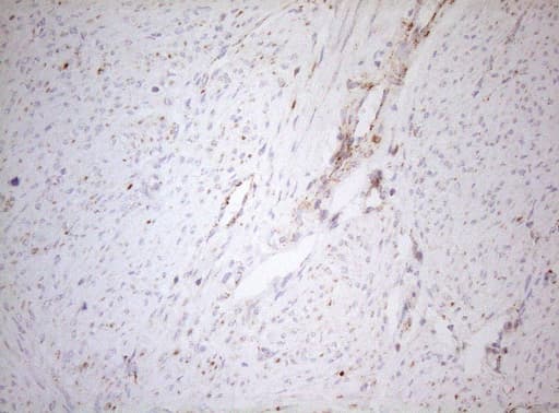 Monoclonal Mouse anti-Human DECR1 Antibody (clone OTI4G4, IHC, WB)