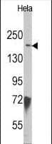 KDM6B / JMJD3 Antibody (aa1-30)