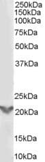 IHC-plus™ TGIF2 Antibody (aa211-220)