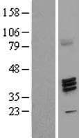 Human FUT7 Protein (Over-Expression Lysate Myc-DDK (Flag))
