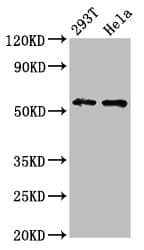 EPOR / EPO Receptor Antibody (aa320-506)