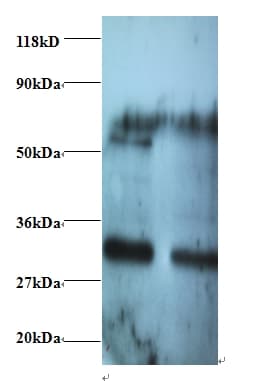 IHC-plus™ ARHGEF18 Antibody