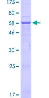 Human HSD3B7 Protein (Recombinant GST)