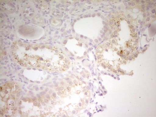 TRB3 / TRIB3 Antibody (aa1-200, clone OTI3F6)