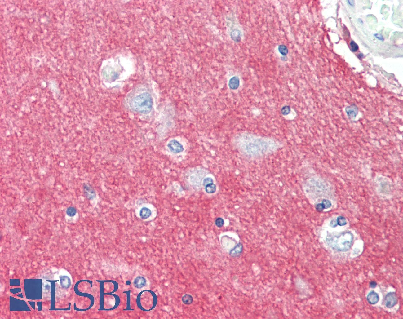 Polyclonal Rabbit anti-Human GNAI3 Antibody (aa181-230, IHC, WB)