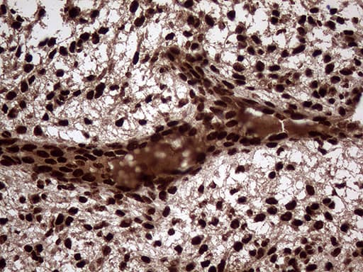 TALDO1 / Transaldolase 1 Antibody (clone OTI2E4)