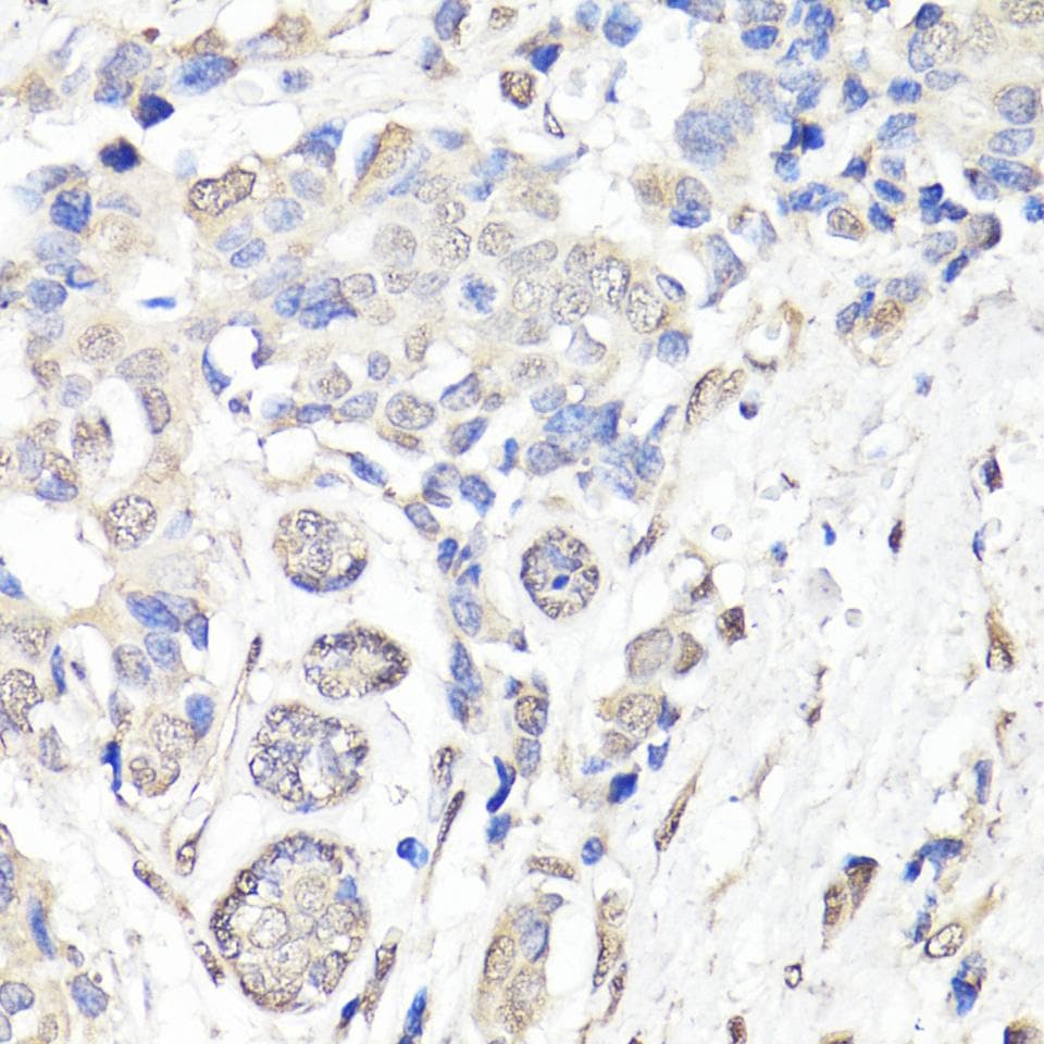 BAP1 Antibody