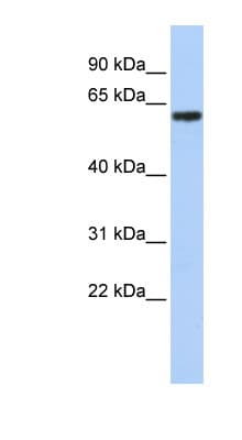 Polyclonal Rabbit anti-Human TBX18 Antibody (aa511-560, IHC, WB)