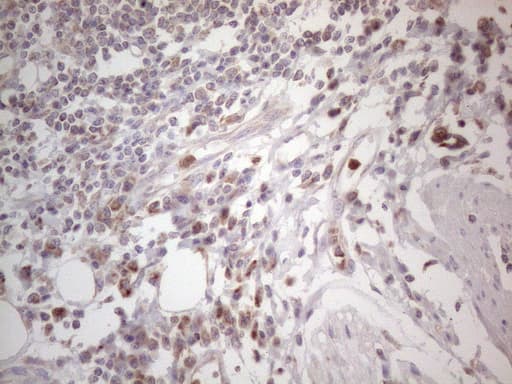 SDHB Antibody (clone OTI1H6)