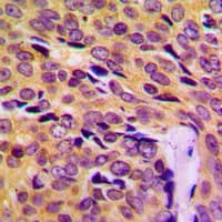 MRPL14 Antibody (C-Terminus)