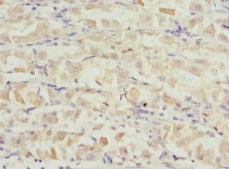 VANGL2 / LTAP Antibody
