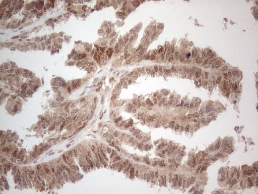 IRS1 Antibody (aa1-280, clone OTI9E11)