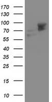 ALDH3A2 Antibody (clone OTI 1B11)