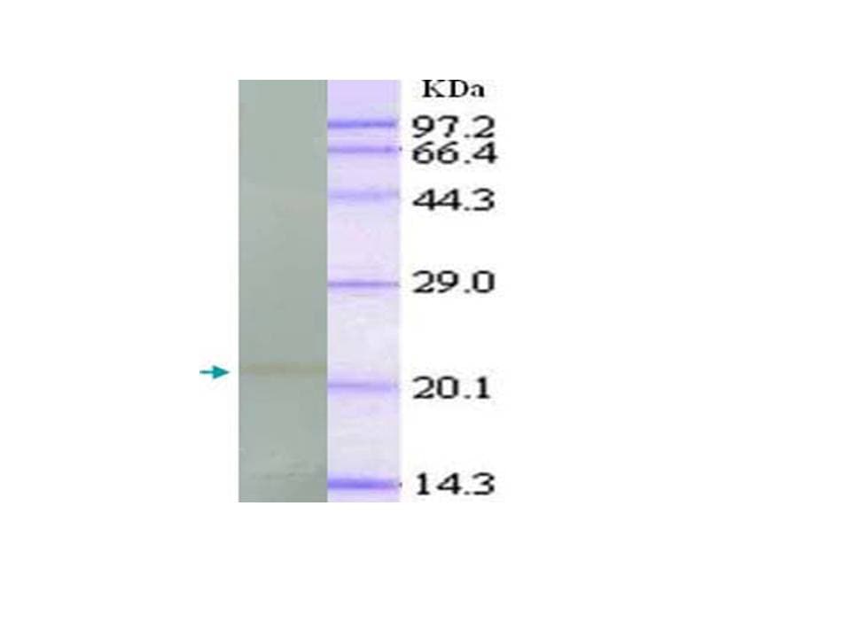 TNF Alpha Antibody