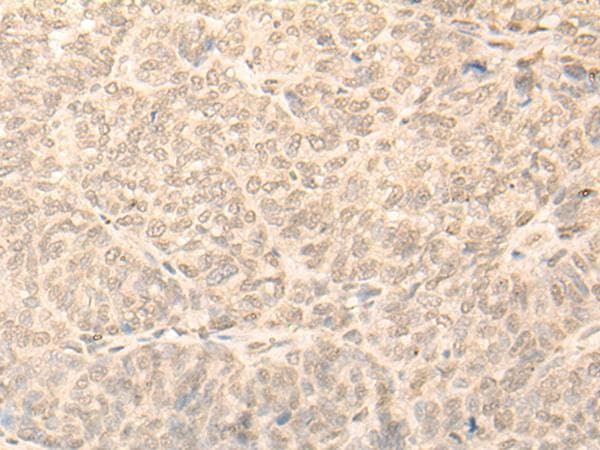 NARF Antibody