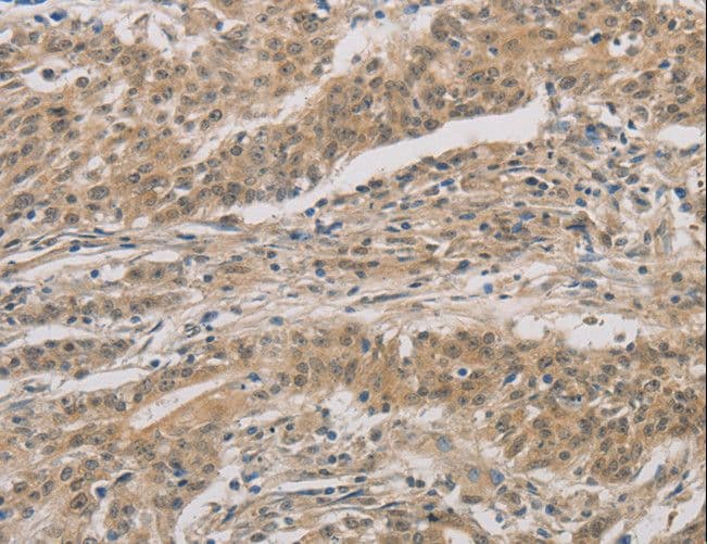 DDIT4 / REDD1 Antibody