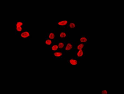HIST1H4I Antibody