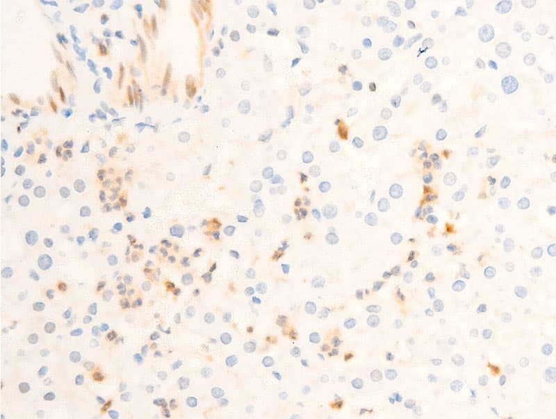 ICAM-1 / CD54 Antibody (phospho-Tyr512)