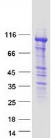 Human FAK / Focal Adhesion Kinase Protein (Recombinant Myc-DDK (Flag))