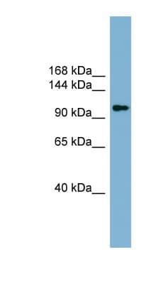 ACLY / ATP Citrate Lyase Antibody (aa451-500)