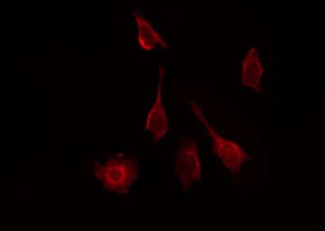 Polyclonal Rabbit anti-Human RPS9 / Ribosomal Protein S9 Antibody (IF, WB)