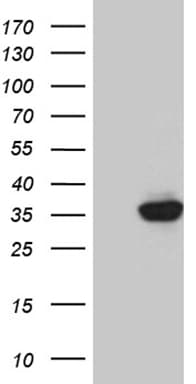 PDIK1L Antibody (aa131-341, clone OTI4G1)