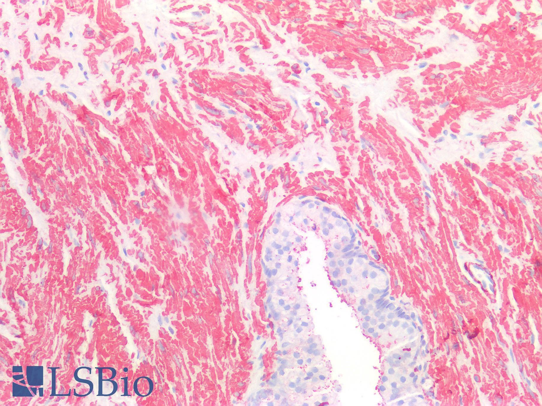 SMMHC / MYH11 Antibody (aa211-482)