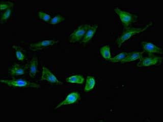 LSMEM1 / C7orf53 Antibody