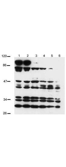 PathPlus™ NOTCH2 Antibody (aa2390-2415)