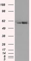 ATP5B / ATP Synthase Beta Antibody (clone OTI1B10)