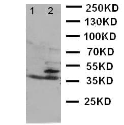 BCAT1 / ECA39 Antibody (aa360-375)