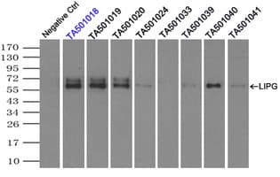 LIPG / Endothelial Lipase Antibody (clone OTI6E11)