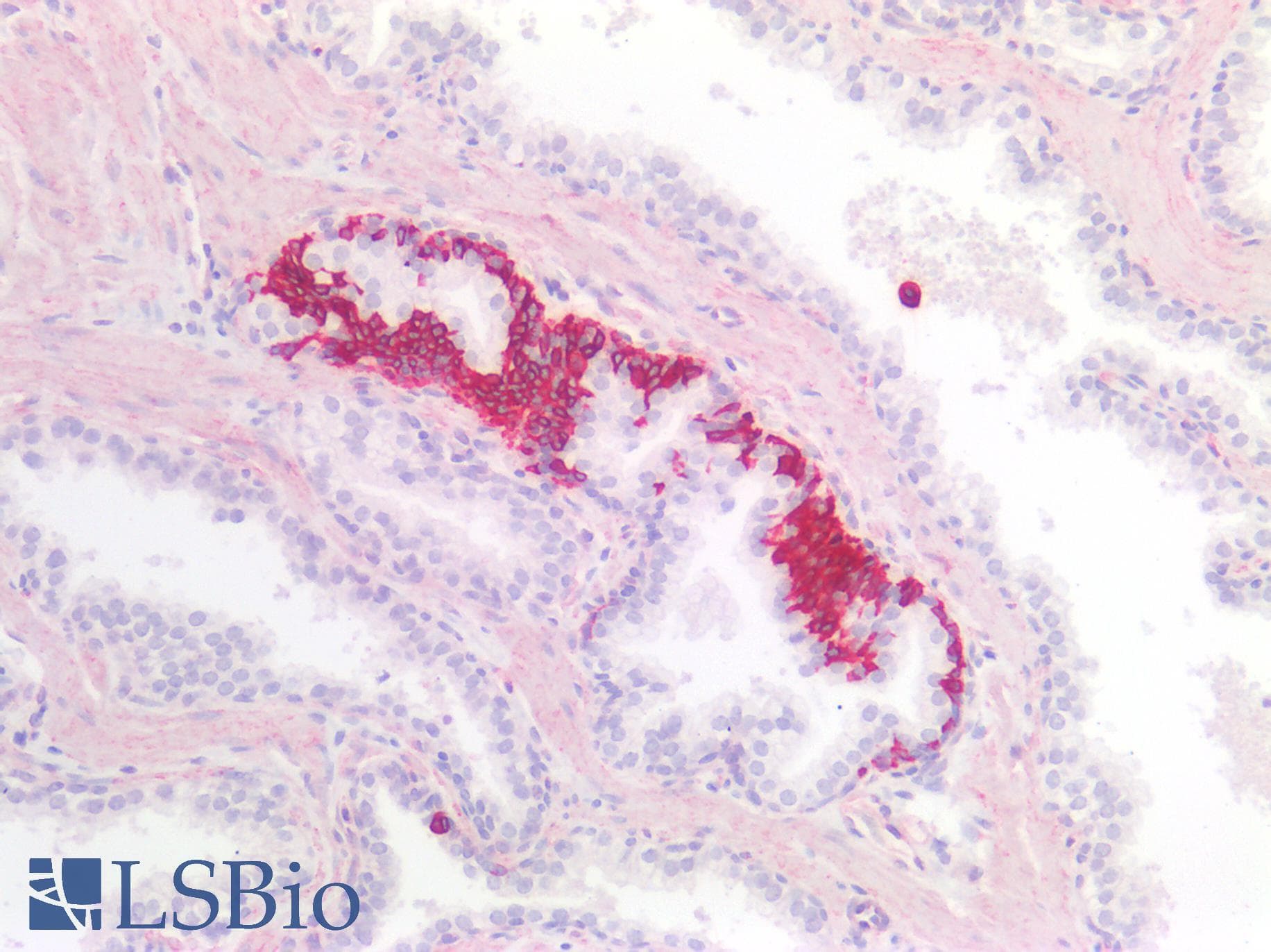PathPlus™ KRT13 / CK13 / Cytokeratin 13 Antibody