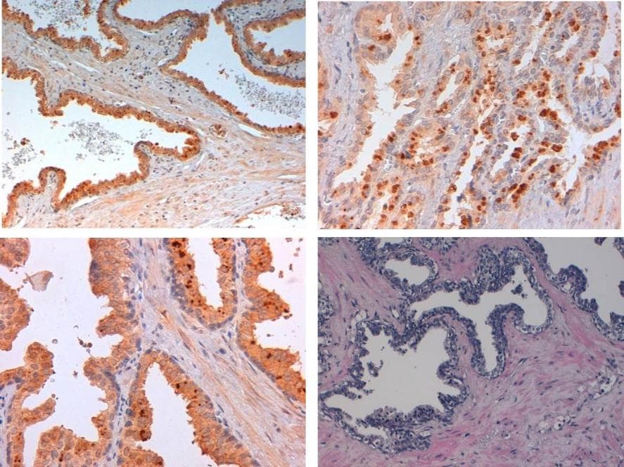 SLIT2 Antibody