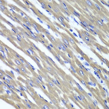 IHC-plus™ SDHA Antibody