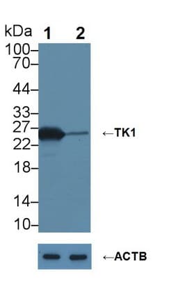 Monoclonal Mouse anti-Human TK1 / TK / Thymidine Kinase Antibody (WB)
