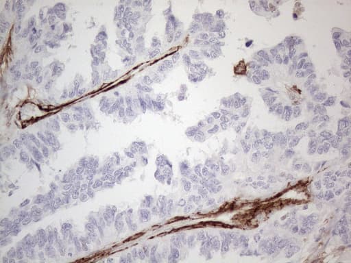 ANPEP / CD13 Antibody (aa668-967, clone OTI2E4, Carrier-free)