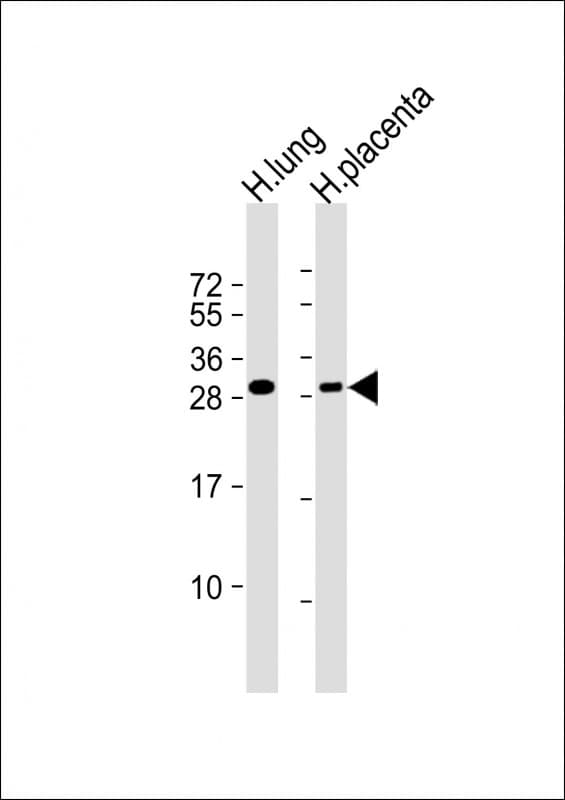 RGS19 Antibody (Ser24, aa 9-39)