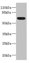 Polyclonal Rabbit anti-Human ALCAM / CD166 Antibody (IHC, WB)