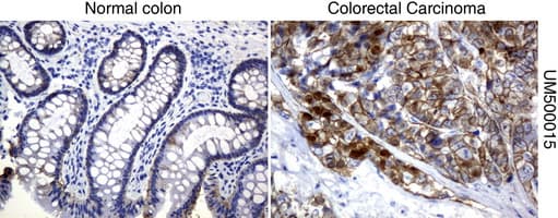 Monoclonal Mouse anti-Human CTNNB1 / Beta Catenin Antibody (clone UMAB15, Carrier-free, IHC, IF, WB)