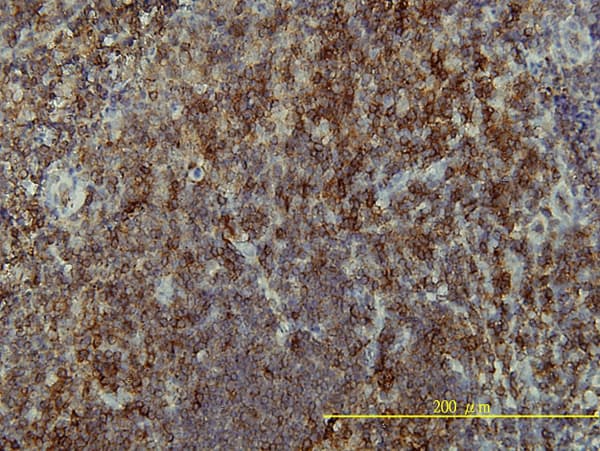 LAT Antibody (clone 3B11-1D5)