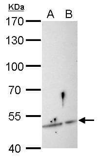 IHC-plus™ Polyclonal Rabbit anti-Human SESN3 Antibody (aa21-296, IHC, WB)