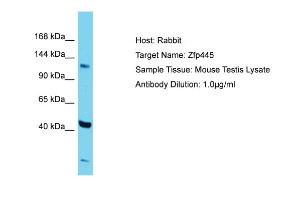 ZNF445 Antibody (aa406-455)