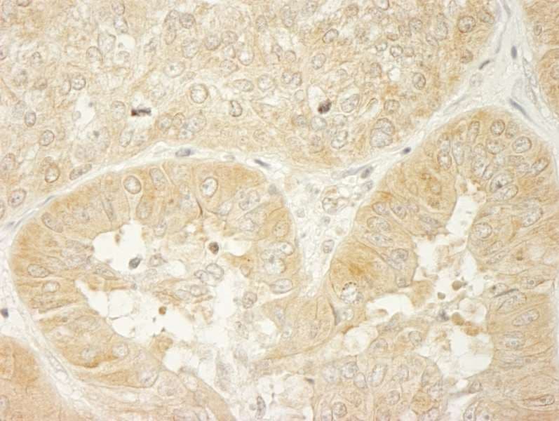 Polyclonal Rabbit anti-Human LARP1 / La-Related Protein 1 Antibody (aa575-625, IHC, WB)